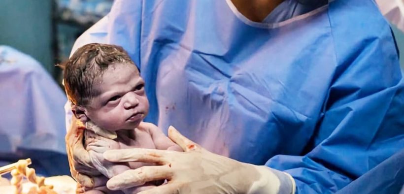 Baby Isa Viral Terlahir Cemberut